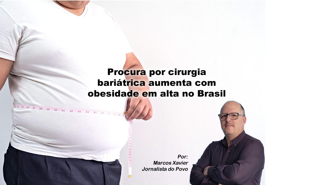 Cirurgia bariátrica: uma opção para pacientes com obesidade grave