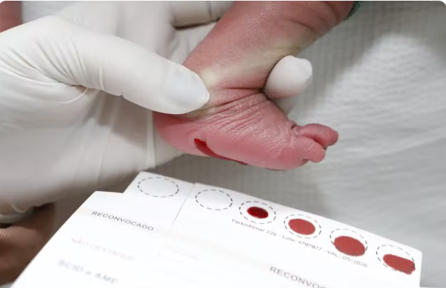 Teste do Pezinho pode salvar vidas: exame deve ser feito nos primeiros dias do bebê
